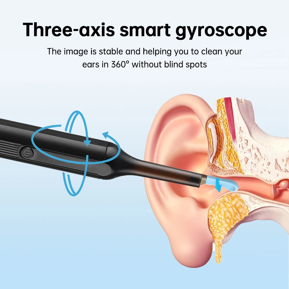 Smart ear cleaner with HD camera and WiFi