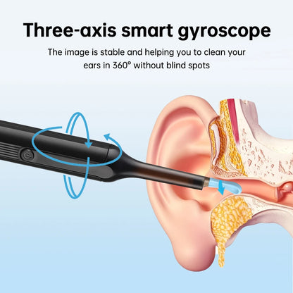 Smart ear cleaner with HD camera and WiFi