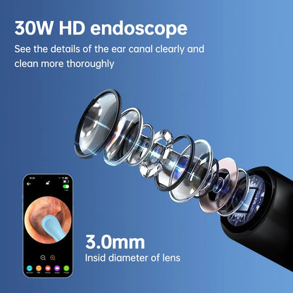 Smart ear cleaner with HD camera and WiFi